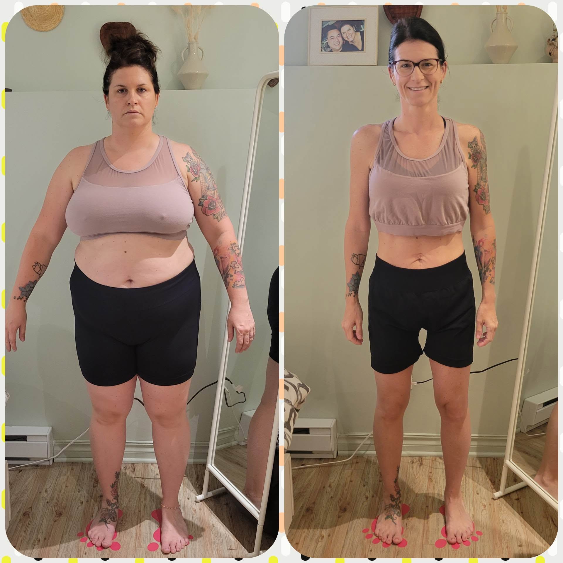 Sleeve gastrique mexique